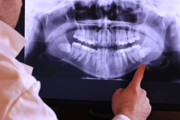 Best Mobile Emergency Dentist in Charleston, SC