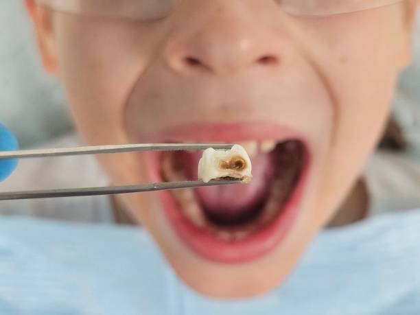 Best Holiday Emergency Dentist in Charleston, SC